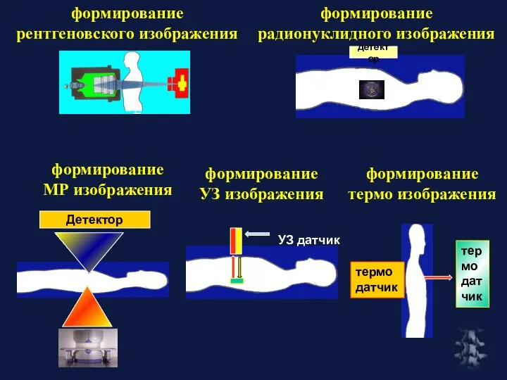 формирование радионуклидного изображения формирование рентгеновского изображения формирование МР изображения формирование термо изображения формирование УЗ изображения