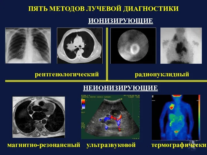 ПЯТЬ МЕТОДОВ ЛУЧЕВОЙ ДИАГНОСТИКИ рентгенологический радионуклидный термографический магнитно-резонансный ультразвуковой ИОНИЗИРУЮЩИЕ НЕИОНИЗИРУЮЩИЕ