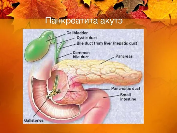 Панкреатита акутэ