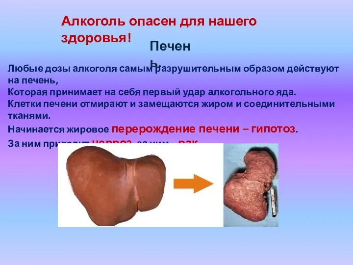 Алкоголь опасен для нашего здоровья! Печень. Любые дозы алкоголя самым разрушительным