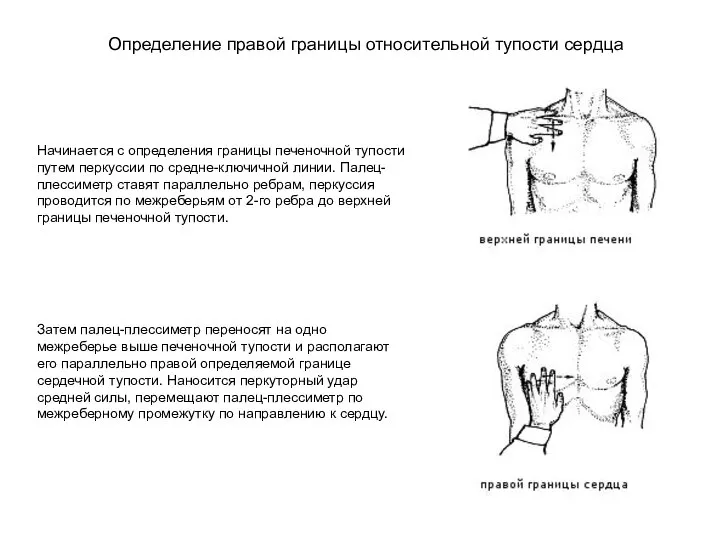 Начинается с определения границы печеночной тупости путем перкуссии по средне-ключичной линии.