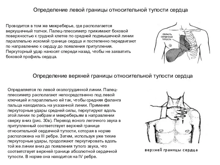 Проводится в том же межреберье, где располагается верхушечный толчок. Палец-плессиметр прижимают