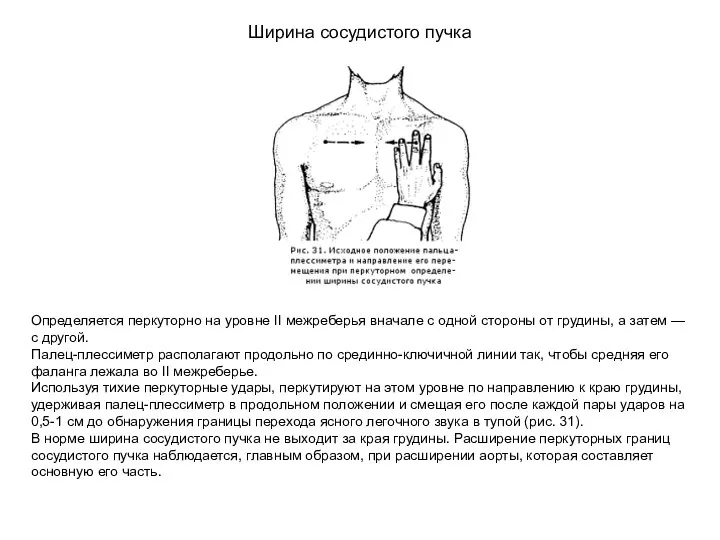 Ширина сосудистого пучка Определяется перкуторно на уровне II межреберья вначале с