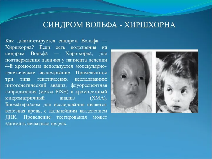 Как диагностируется синдром Вольфа — Хиршхорна? Если есть подозрения на синдром