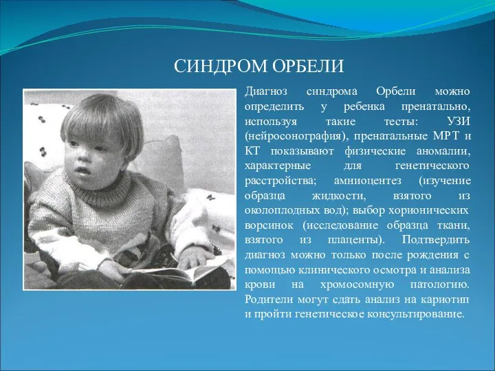 СИНДРОМ ОРБЕЛИ Диагноз синдрома Орбели можно определить у ребенка пренатально, используя