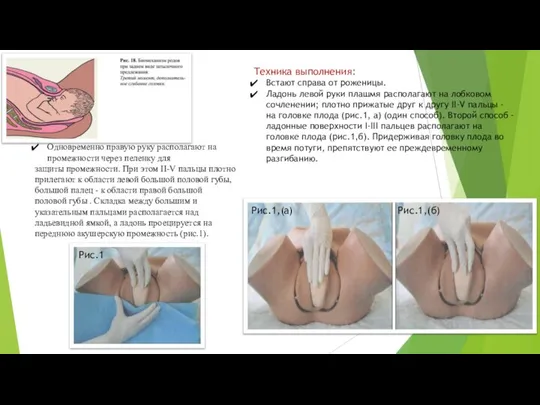 Техника выполнения: Встают справа от роженицы. Ладонь левой руки плашмя располагают