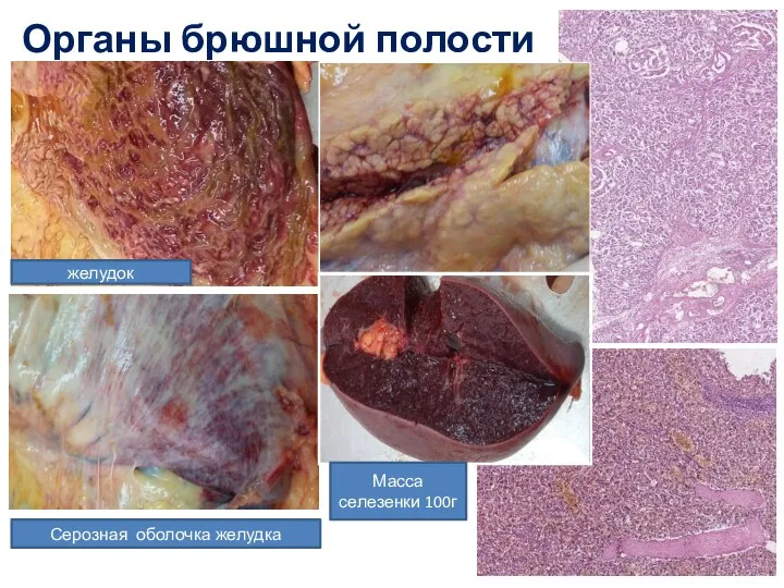 Органы брюшной полости желудок Серозная оболочка желудка Масса селезенки 100г