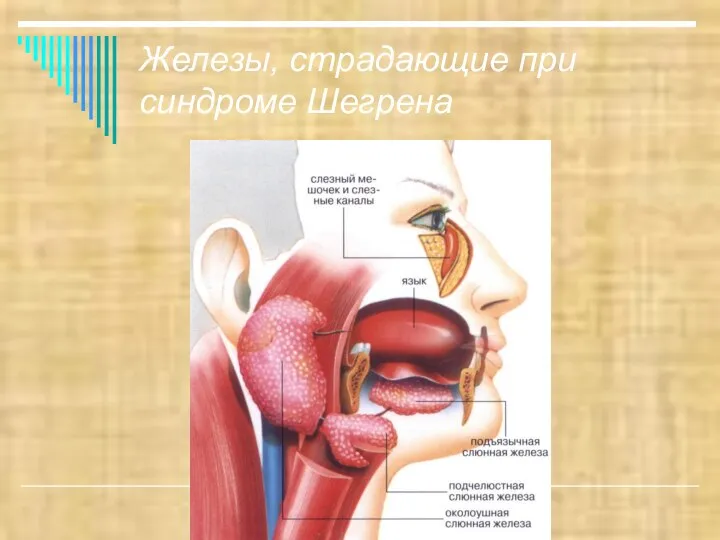 Железы, страдающие при синдроме Шегрена