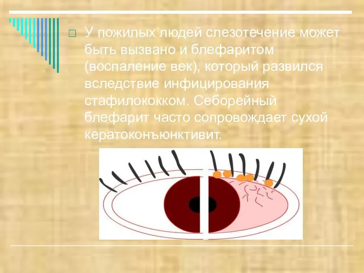 У пожилых людей слезотечение может быть вызвано и блефаритом (воспаление век),