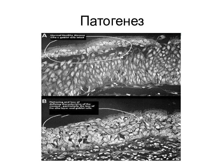 Патогенез