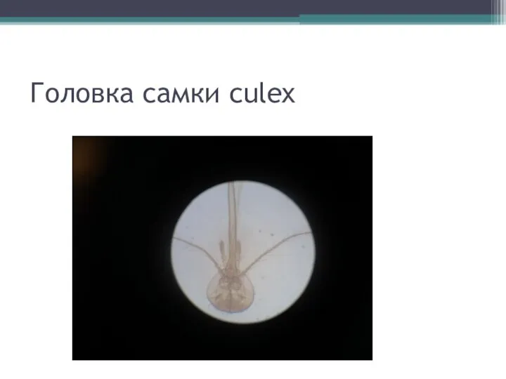 Головка самки culex