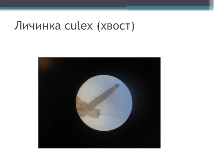 Личинка culex (хвост)