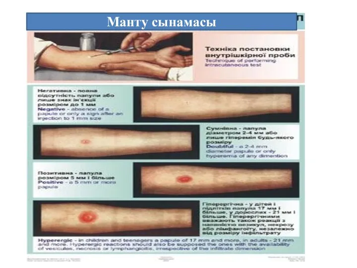 Манту сынамасы