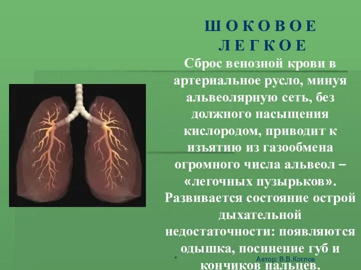 ШОК - ЭТО АКТИВНАЯ ЗАЩИТА ОРГАНИЗМА ОТ АГРЕССИИ СРЕДЫ Ш О