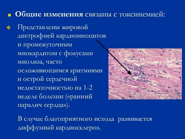 Общие изменения связаны с токсинемией: Представлены жировой дистрофией кардиомиоцитов и промежуточным