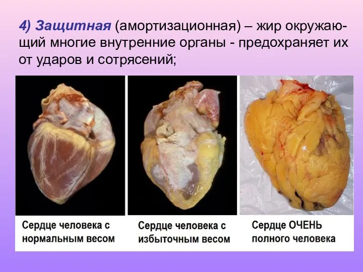 4) Защитная (амортизационная) – жир окружаю-щий многие внутренние органы - предохраняет их от ударов и сотрясений;