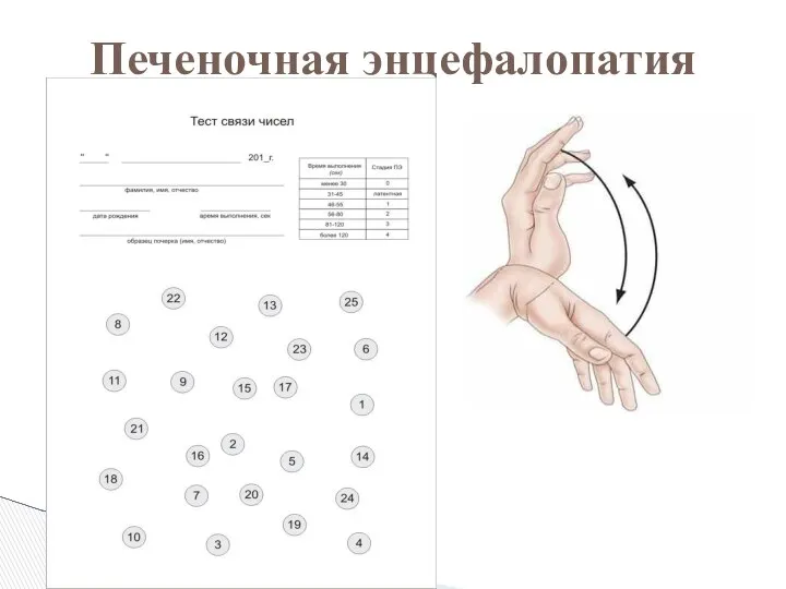 Печеночная энцефалопатия