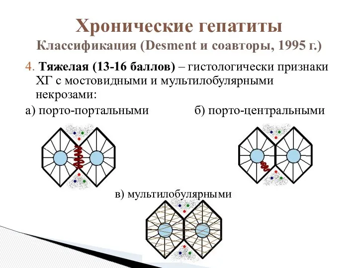 4. Тяжелая (13-16 баллов) – гистологически признаки ХГ с мостовидными и