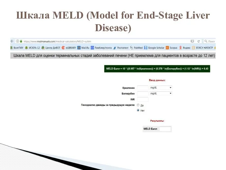 Шкала MELD (Model for End-Stage Liver Disease)