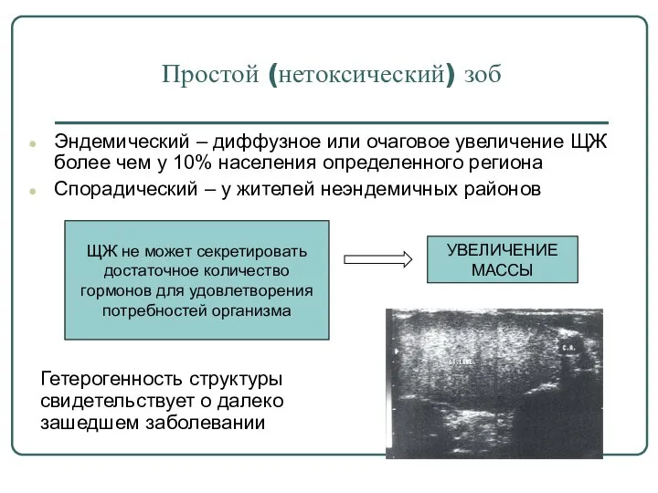 Простой (нетоксический) зоб Эндемический – диффузное или очаговое увеличение ЩЖ более