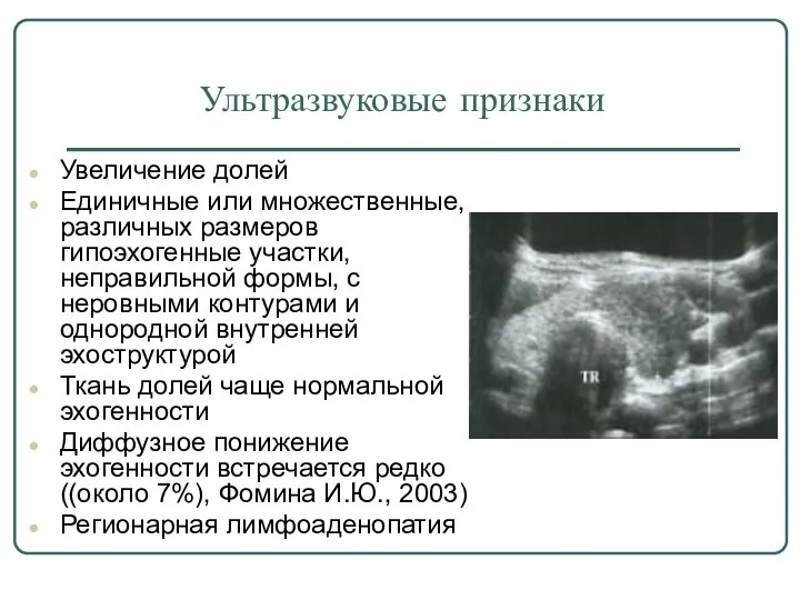 Ультразвуковые признаки Увеличение долей Единичные или множественные, различных размеров гипоэхогенные участки,