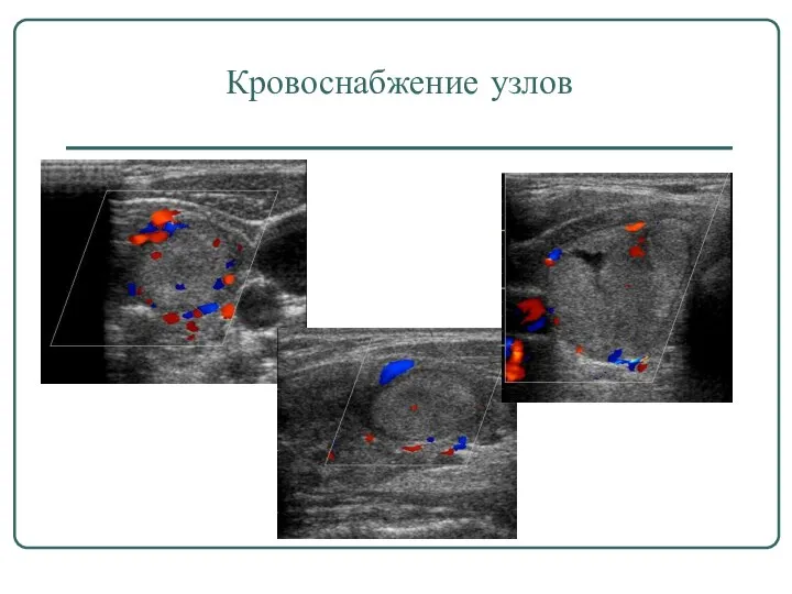 Кровоснабжение узлов