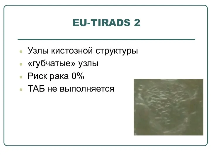 EU-TIRADS 2 Узлы кистозной структуры «губчатые» узлы Риск рака 0% ТАБ не выполняется