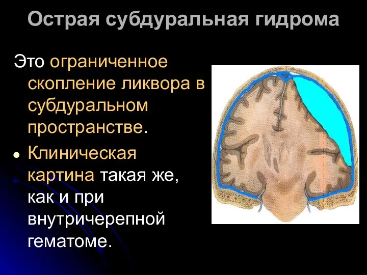 Острая субдуральная гидрома Это ограниченное скопление ликвора в субдуральном пространстве. Клиническая