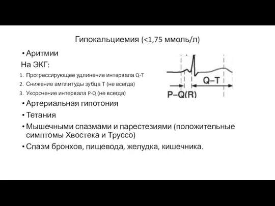 Гипокальциемия ( Аритмии На ЭКГ: Прогрессирующее удлинение интервала Q-T Снижение амплитуды