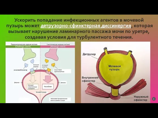 Ускорить попадание инфекционных агентов в мочевой пузырь может детрузорно-сфинктерная диссинергия, которая