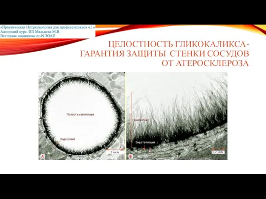 ЦЕЛОСТНОСТЬ ГЛИКОКАЛИКСА- ГАРАНТИЯ ЗАЩИТЫ СТЕНКИ СОСУДОВ ОТ АТЕРОСКЛЕРОЗА