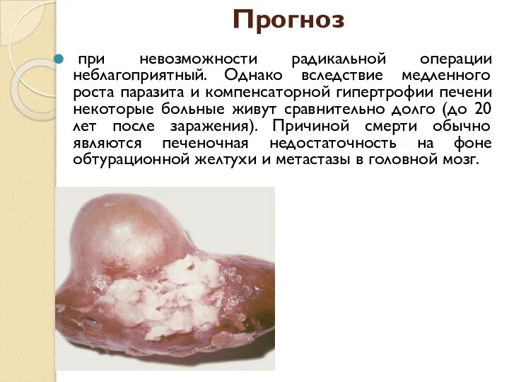 Прогноз при невозможности радикальной операции неблагоприятный. Однако вследствие медленного роста паразита