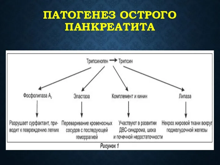 ПАТОГЕНЕЗ ОСТРОГО ПАНКРЕАТИТА