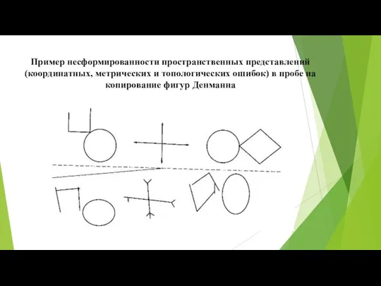 Пример несформированности пространственных представлений (координатных, метрических и топологических ошибок) в пробе на копирование фигур Денманна