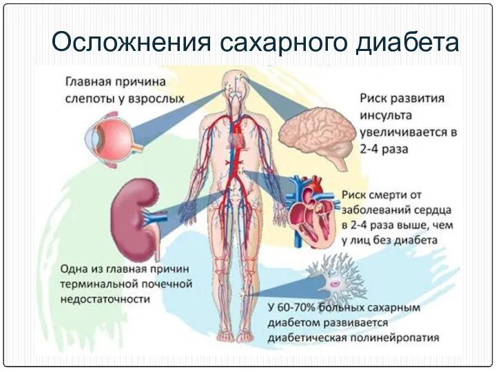 Осложнения сахарного диабета