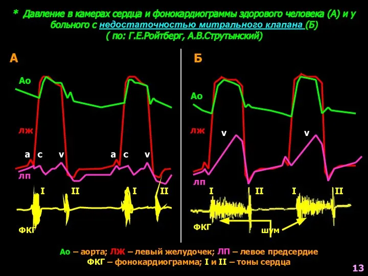 * Давление в камерах сердца и фонокардиограммы здорового человека (А) и