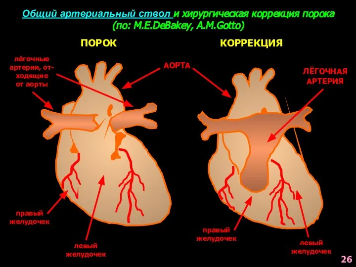 Общий артериальный ствол и хирургическая коррекция порока (по: M.E.DeBakey, A.M.Gotto) АОРТА