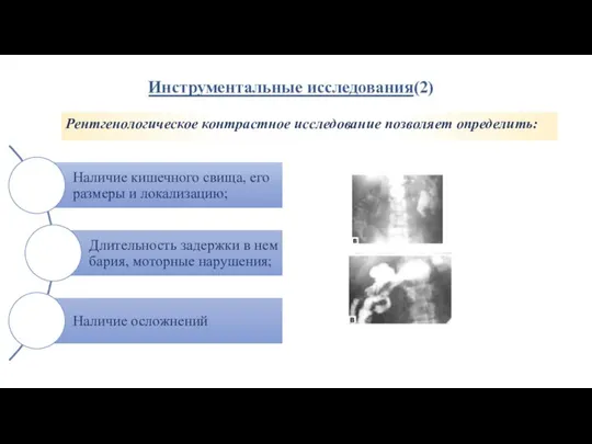 Инструментальные исследования(2) Рентгенологическое контрастное исследование позволяет определить: