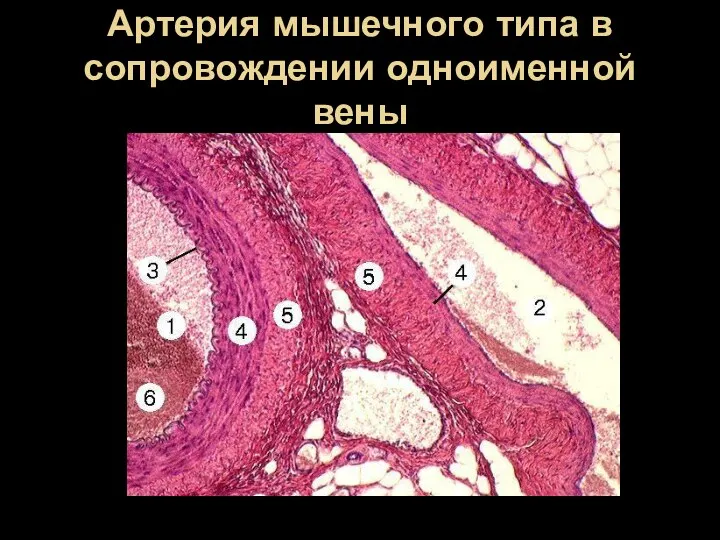 Артерия мышечного типа в сопровождении одноименной вены