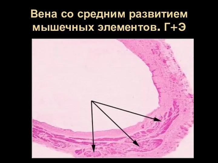 Вена со средним развитием мышечных элементов. Г+Э