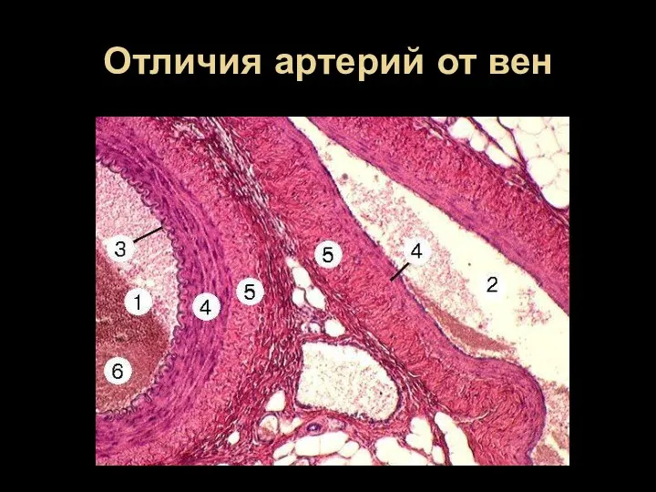 Отличия артерий от вен