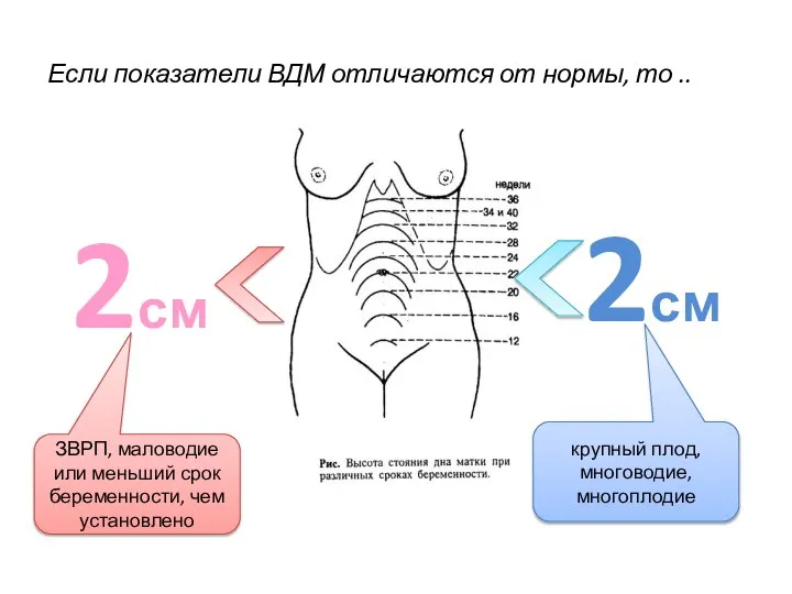 Если показатели ВДМ отличаются от нормы, то .. 2см 2см ЗВРП,