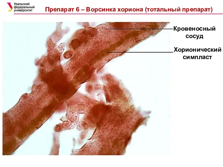 Хорионический симпласт Кровеносный сосуд Препарат 6 – Ворсинка хориона (тотальный препарат)