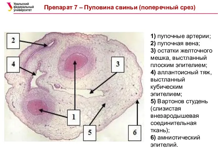 Препарат 7 – Пуповина свиньи (поперечный срез) 1) пупочные артерии; 2)