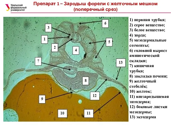 Препарат 1 – Зародыш форели с желточным мешком (поперечный срез) 1)