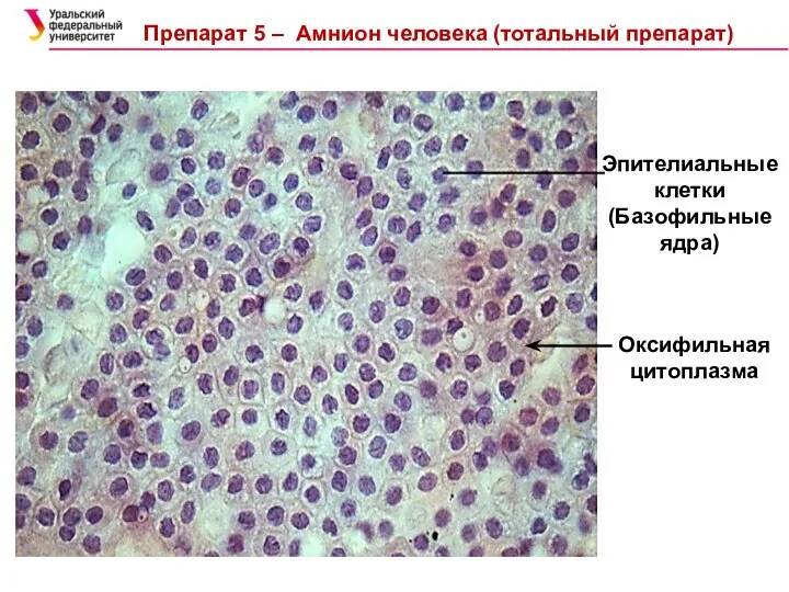 Эпителиальные клетки (Базофильные ядра) Препарат 5 – Амнион человека (тотальный препарат) Оксифильная цитоплазма