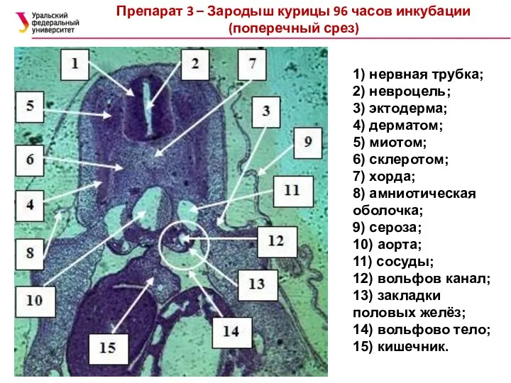 Препарат 3 – Зародыш курицы 96 часов инкубации (поперечный срез) 1)