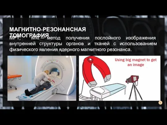 МАГНИТНО-РЕЗОНАНСНАЯ ТОМОГРАФИЯ МРТ, MRI — метод получения послойного изображения внутренней структуры