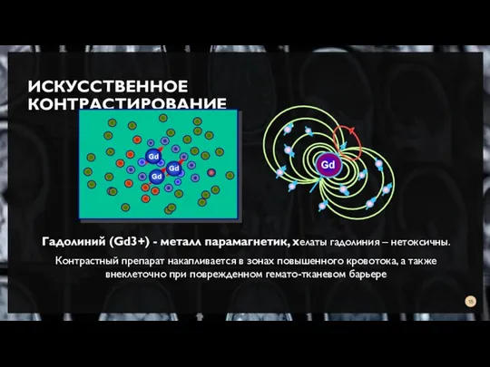 ИСКУССТВЕННОЕ КОНТРАСТИРОВАНИЕ Гадолиний (Gd3+) - металл парамагнетик, хелаты гадолиния – нетоксичны.