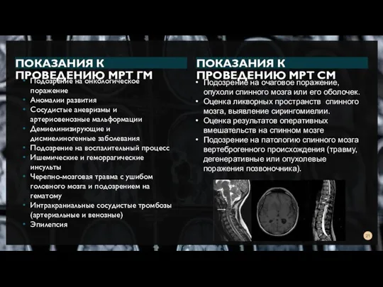 ПОКАЗАНИЯ К ПРОВЕДЕНИЮ МРТ ГМ Подозрение на онкологическое поражение Аномалии развития